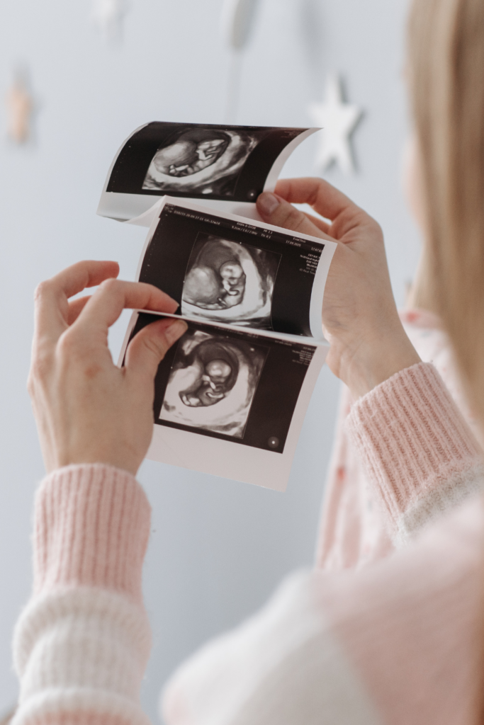 woman holding ultrasound pictures