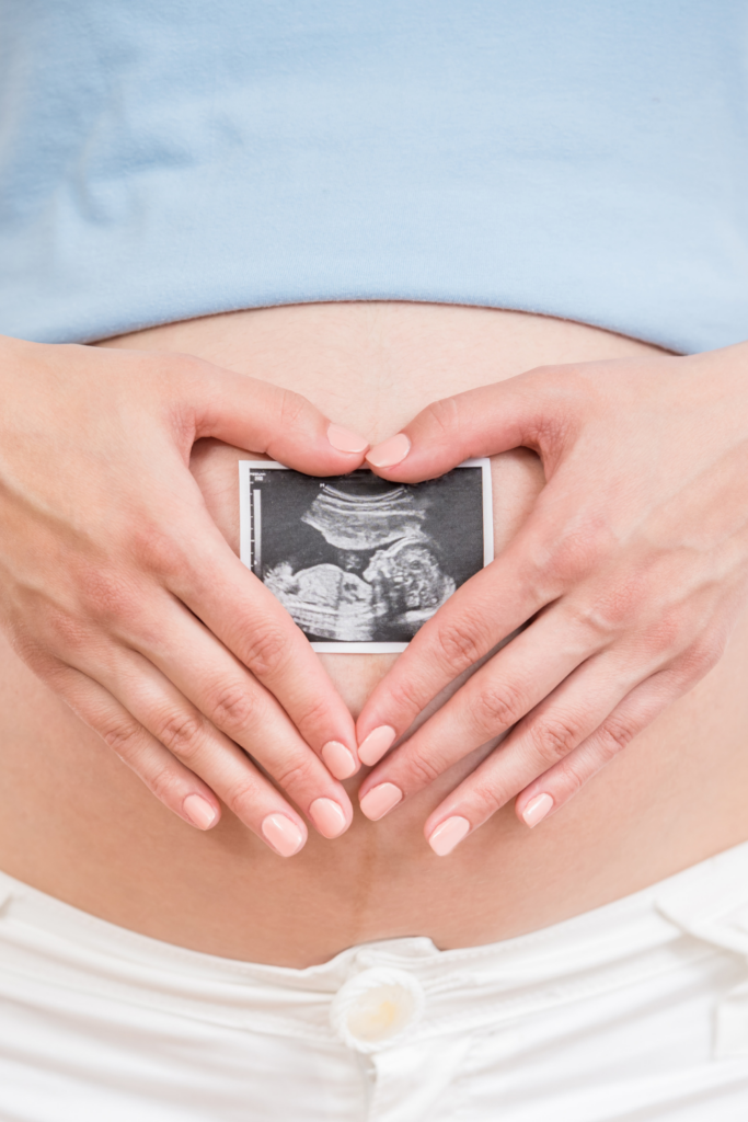 woman holding ultrasound picture on pregnant belly
