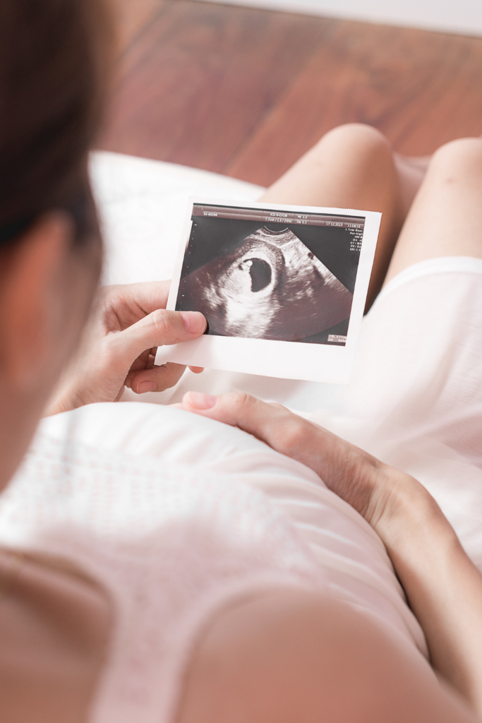 pregnant woman holding ultrasound picture