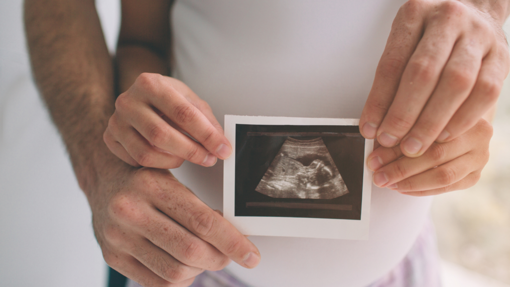 couple holding ultrasound picture